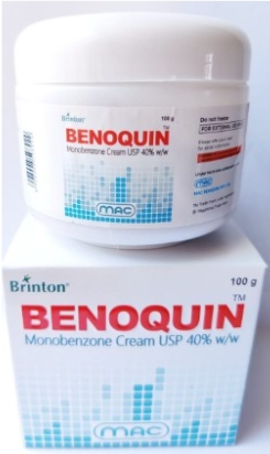 백반증 모노벤존 크림 베노퀸 BENOQUIN CREAM 20g